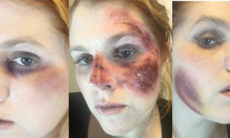 wound makeup feature weeks 6-7